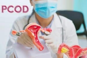 PCOD Treatment in Marthandam