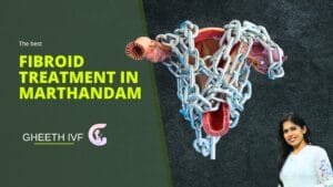 Fibroid Treatment in Marthandam